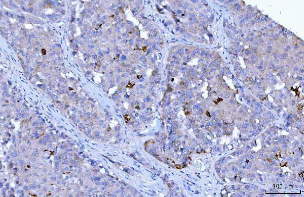 m01174 1 hgs primary antibodies ihc testing 5