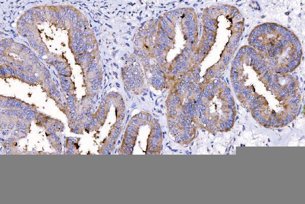 m01174 1 hgs primary antibodies ihc testing 7
