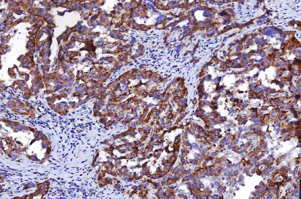 m01174 1 hgs primary antibodies ihc testing 8
