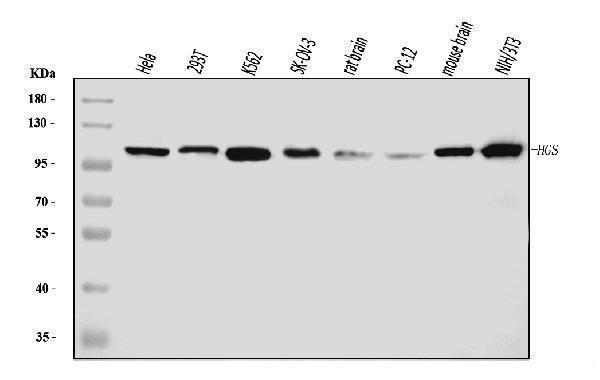  Western blot analysis of HGS using anti-HGS antibody (M00179-1)