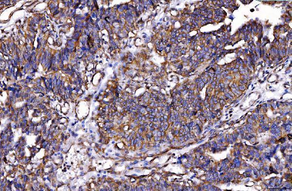  IHC analysis of HGS using anti-HGS antibody (M01174-2)