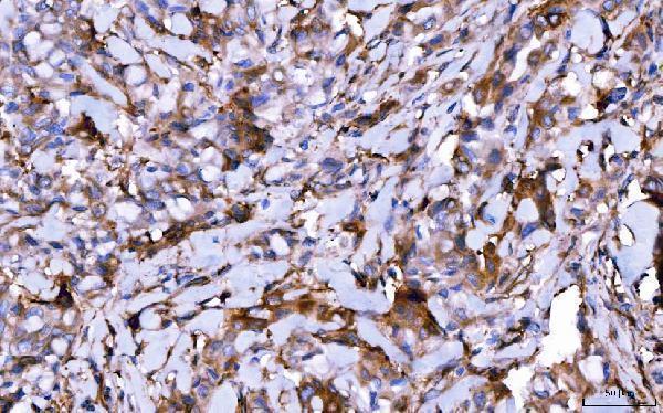 m01174 2 hgs primary antibodies ihc testing 3_1