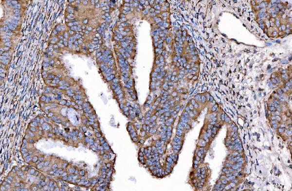 m01174 2 hgs primary antibodies ihc testing 5