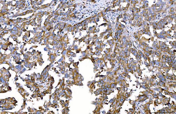 m01174 2 hgs primary antibodies ihc testing 7_1