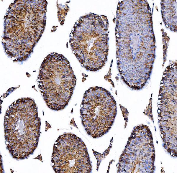m01174 2 hgs primary antibodies ihc testing 8_1