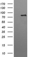 HEK293T cells were transfected with the pCMV6-ENTRY control (Left lane) or pCMV6-ENTRY HGS (Right lane) cDNA for 48 hrs and lysed