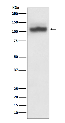 Western blot analysis of SERCA2 expression in HeLa cell lysate