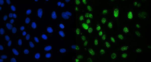 m01180 crm1 primary antibodies if testing 5