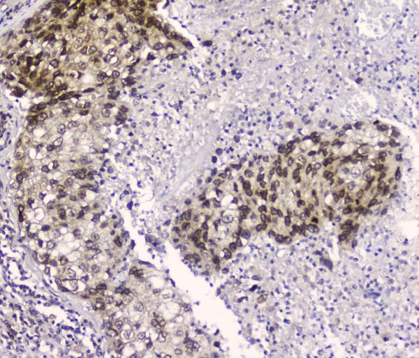 m01180 crm1 primary antibodies ihc testing 2