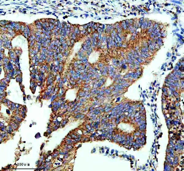 m01187 1 ngfr primary antibodies ihc testing 1