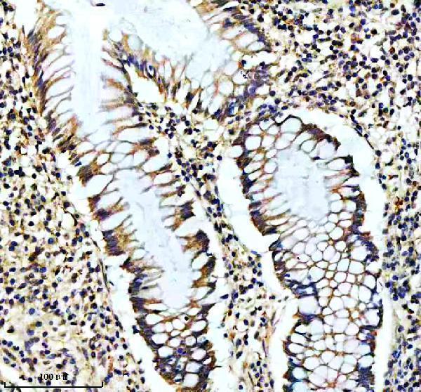 m01187 1 ngfr primary antibodies ihc testing 2