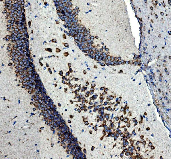 m01187 1 ngfr primary antibodies ihc testing 3