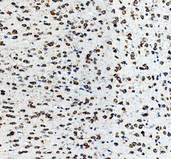 m01187 1 ngfr primary antibodies ihc testing 4