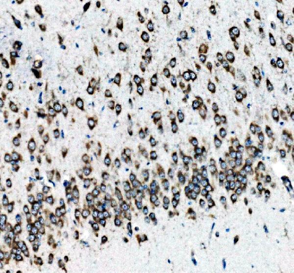 m01187 1 ngfr primary antibodies ihc testing 5