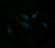 m01188 1 anti cd1c mouse monoclonal antibody clone id oti2f4 if testing 8