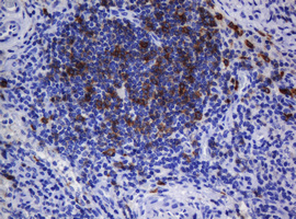 m01188 1 anti cd1c mouse monoclonal antibody clone id oti2f4 ihc testing 5