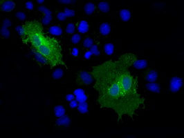 Anti-CD36 mouse monoclonal antibody (M01189-1) immunofluorescent staining of COS7 cells transiently transfected by pCMV6-ENTRY CD36