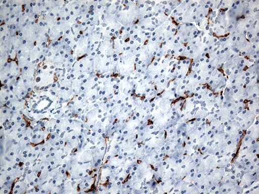Immunohistochemical staining of paraffin-embedded Human pancreas tissue within the normal limits using anti-CD36 mouse monoclonal antibody