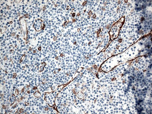m01189 1 anti cd36 mouse monoclonal antibody clone id oti3f4 ihc testing 5