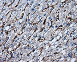 m01189 1 anti cd36 mouse monoclonal antibody clone id oti3f4 ihc testing 7
