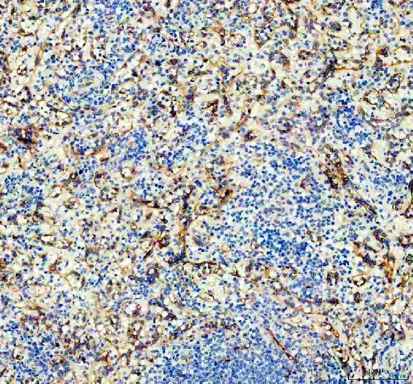 m01189 cd36 primary antibodies ihc testing 1
