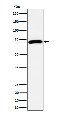 Western blot analysis of Choline Acetyltransferase expression in Mouse brain cell lysate