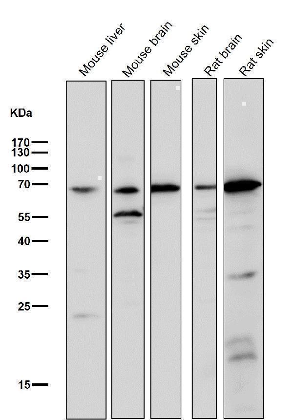 All lanes use the Antibody at 1:2K dilution for 1 hour at room temperature