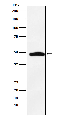 Western blot analysis of MAPKAP Kinase 2 expression in A431 cell lysate