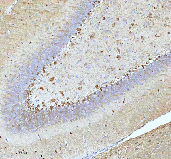 m01194 stmn1 primary antibodies ihc testing 10