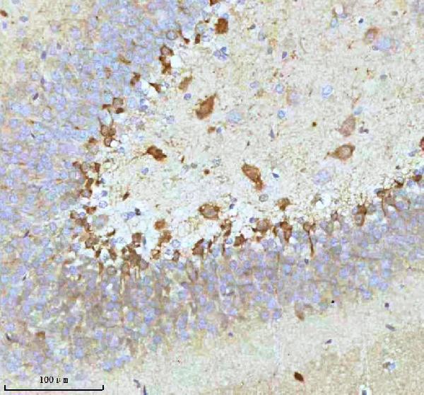 m01194 stmn1 primary antibodies ihc testing 11