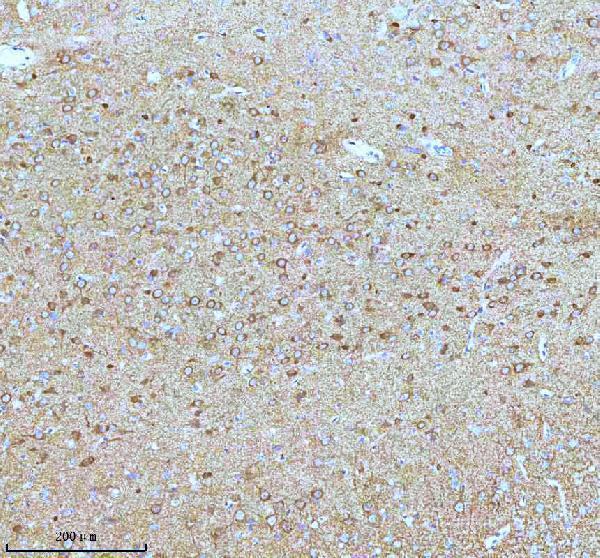 m01194 stmn1 primary antibodies ihc testing 12