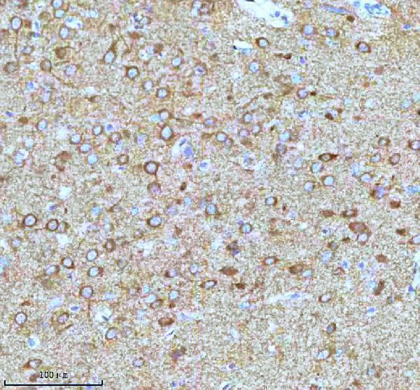 m01194 stmn1 primary antibodies ihc testing 13