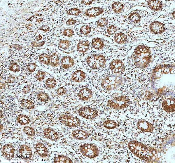  IHC analysis of STMN1 using anti-STMN1 antibody (M01194)