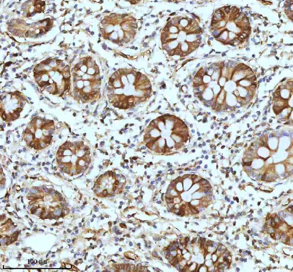  IHC analysis of STMN1 using anti-STMN1 antibody (M01194)