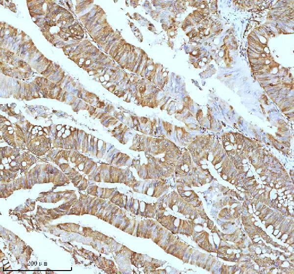 m01194 stmn1 primary antibodies ihc testing 4
