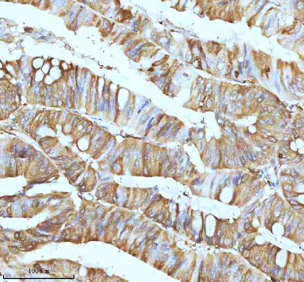 m01194 stmn1 primary antibodies ihc testing 5