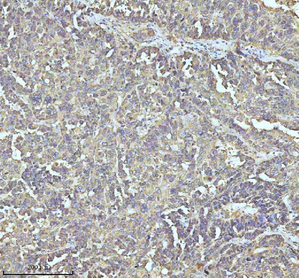 m01194 stmn1 primary antibodies ihc testing 6