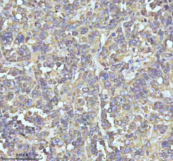 m01194 stmn1 primary antibodies ihc testing 7
