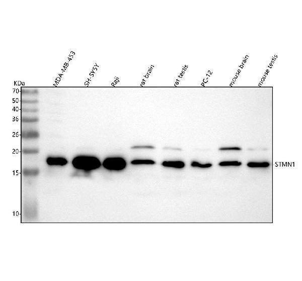  Western blot analysis of Stathmin 1 using anti-Stathmin 1 antibody (M00994)