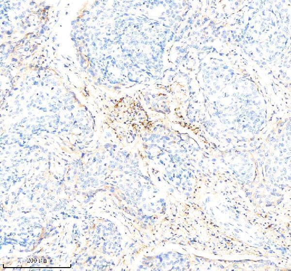 m01195 2 hla dra primary antibodies ihc testing 3