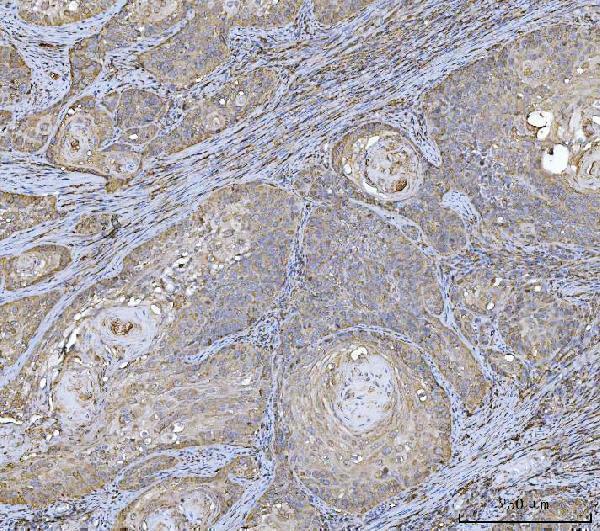  IHC analysis of HLA-DRA using anti-HLA-DRA antibody (M01195-3)