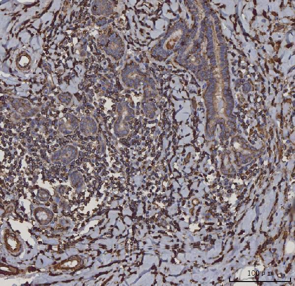  IHC analysis of HLA-DRA using anti-HLA-DRA antibody (M01195-3)