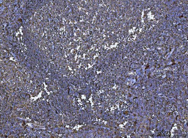 m01195 3 hla dr primary antibodies ihc testing 5