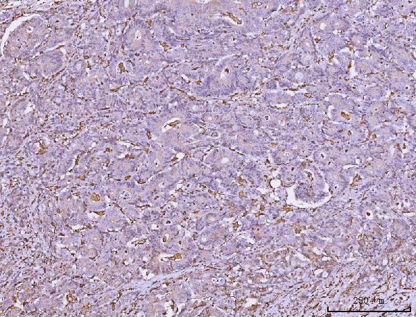  IHC analysis of HLA-DRA using anti-HLA-DRA antibody (M01195-4)