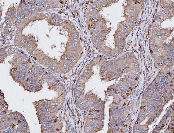  IHC analysis of HLA-DRA using anti-HLA-DRA antibody (M01195-4)