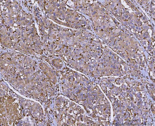 m01195 4 hla dra primary antibodies ihc testing 4