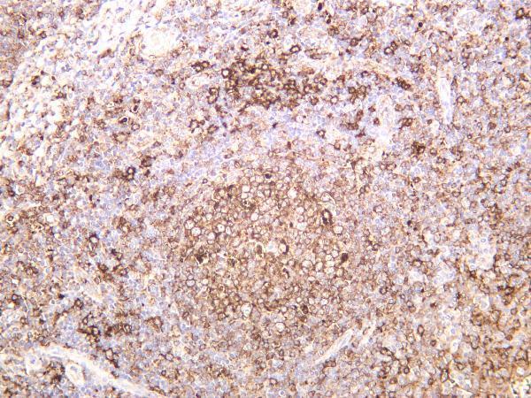 Human tonsil was stained with anti-HLA-DR rabbit antibody
