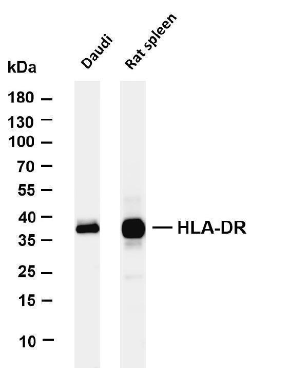 Various whole cell lysates were separated by 4-20% SDS-PAGE, and the membrane was blotted with anti-HLA-DR antibody