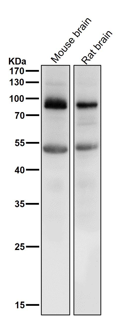All lanes use the Antibody at 1:1K dilution for 1 hour at room temperature