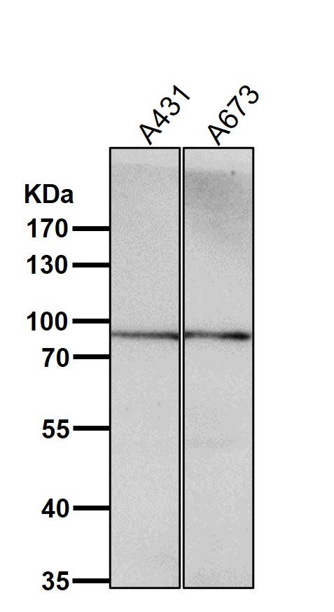 All lanes use the Antibody at 1:2K dilution for 1 hour at room temperature